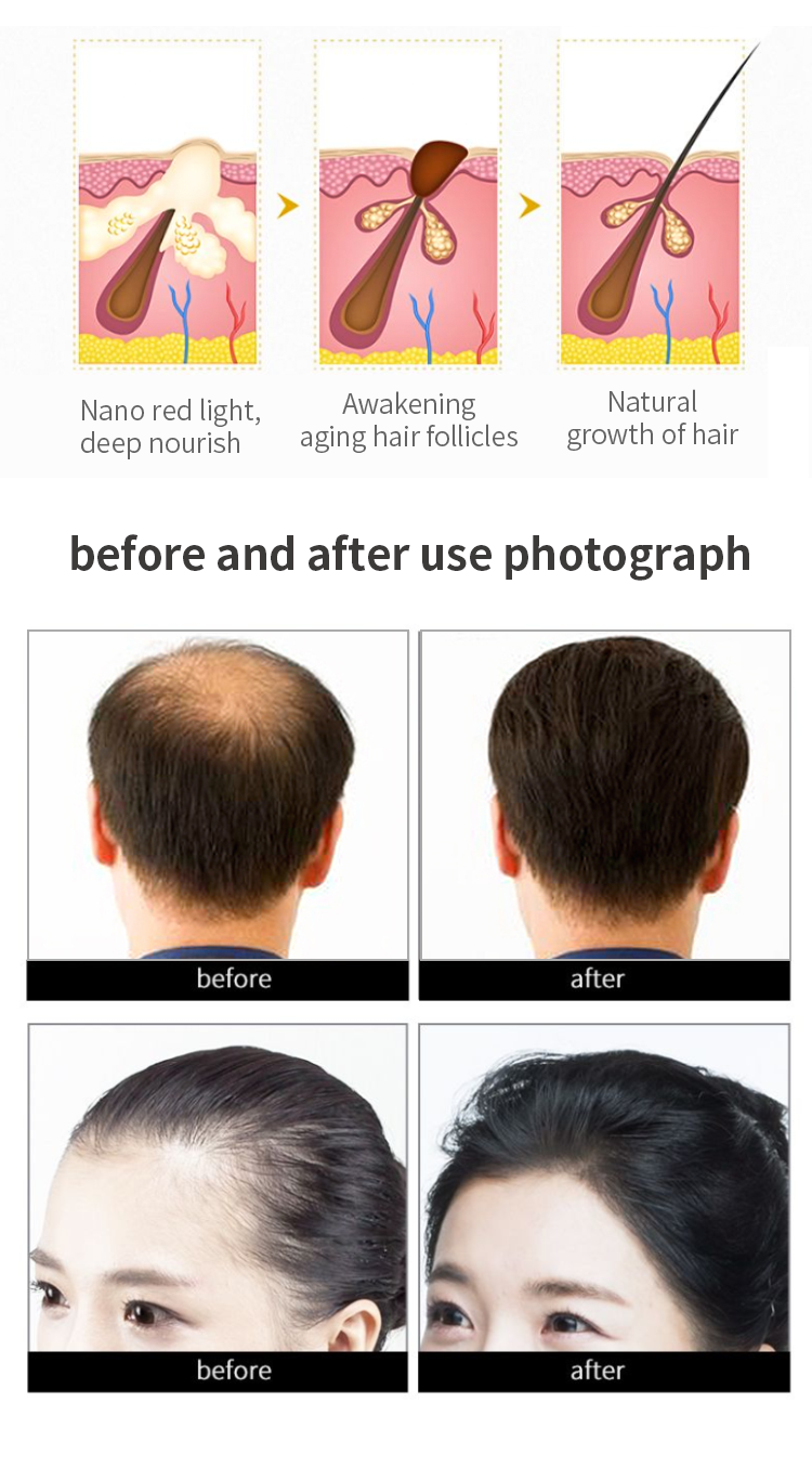 Hair Growth Comb 5633