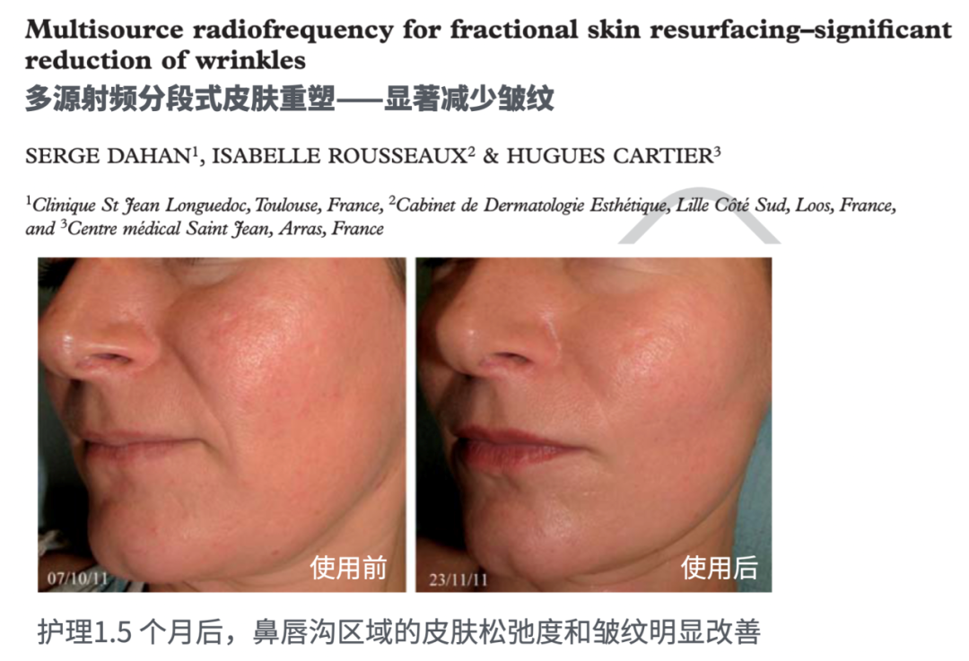 The Evolution Journey of Beauty Devices: From Skincare Apprentice to Anti-Aging Director