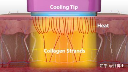 Home RF Beauty Devices: The Art of Circuit Design Balance