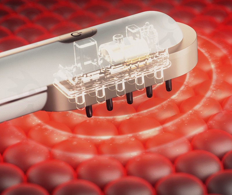 OG- 5636 Hair Growth Comb | | OEM & ODM Supported OG- 5636 Hair Growth Comb | | OEM & ODM Supported