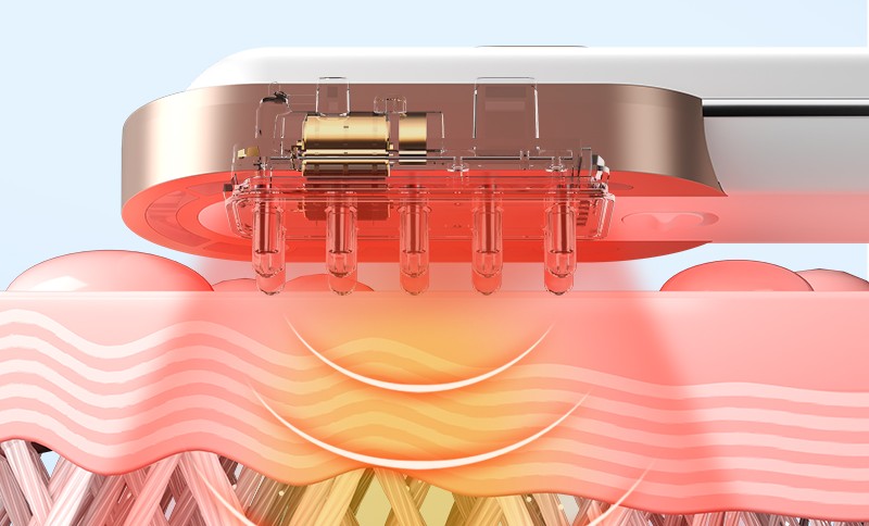 OG- 5636 Hair Growth Comb | | OEM & ODM Supported OG- 5636 Hair Growth Comb | | OEM & ODM Supported